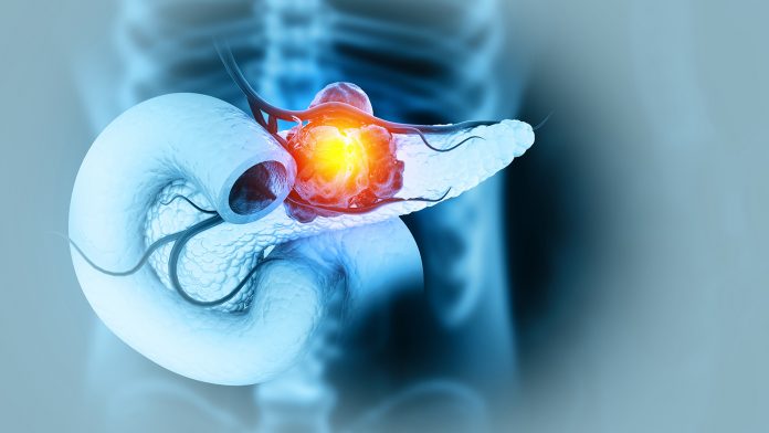 ARM-002TM vaccine shows effectiveness against pancreatic cancer