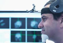 Could personalised transcranial magnetic stimulation revolutionise depression treatment?